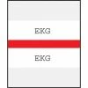 Medical Arts Press® Standard Preprinted Chart Divider Tabs; EKG, Red