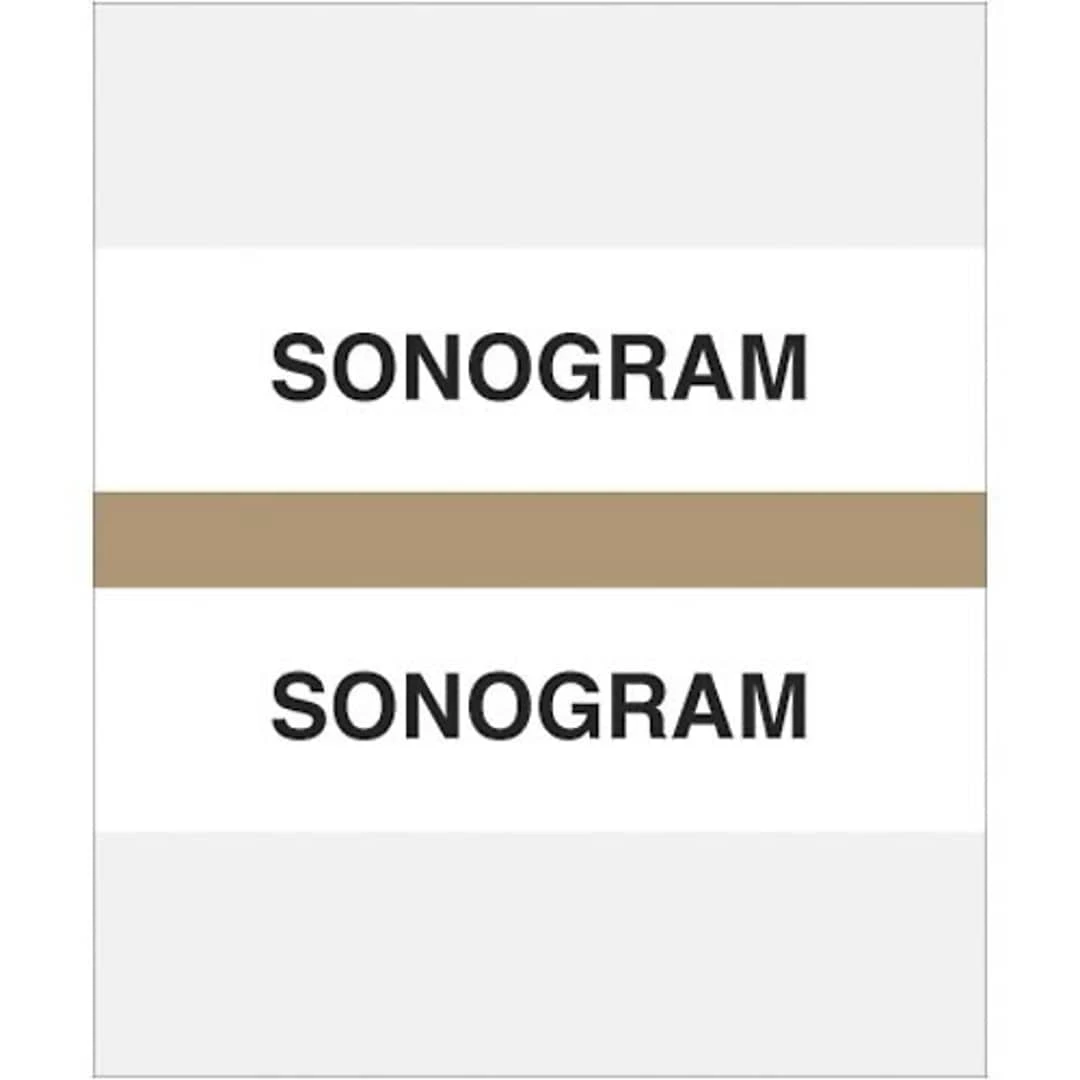 Medical Arts Press® Standard Preprinted Chart Divider Tabs; Sonogram, Tan