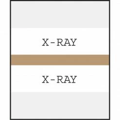 Medical Arts Press® Standard Preprinted Chart Divider Tabs; X-Ray, Tan